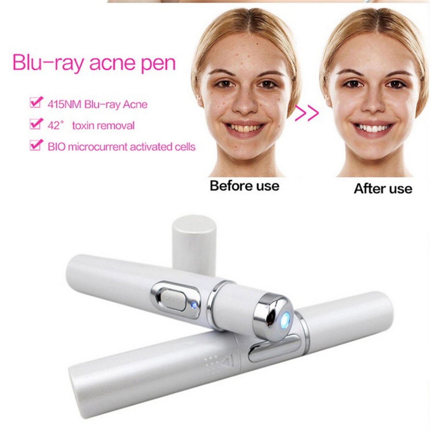 Blue Light Therapy Acne Laser Pen Soft Scar Wrinkle Removal Treatment - Reiland Beauty Products, LLC