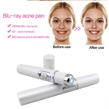 Blue Light Therapy Acne Laser Pen Soft Scar Wrinkle Removal Treatment - Reiland Beauty Products, LLC