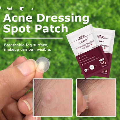 Skin Care Tools Acne Dressing Spot Patch Blemish Treatment Invisible - Reiland Beauty Products, LLC