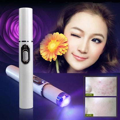 Blue Light Therapy Acne Laser Pen Soft Scar Wrinkle Removal Treatment - Reiland Beauty Products, LLC