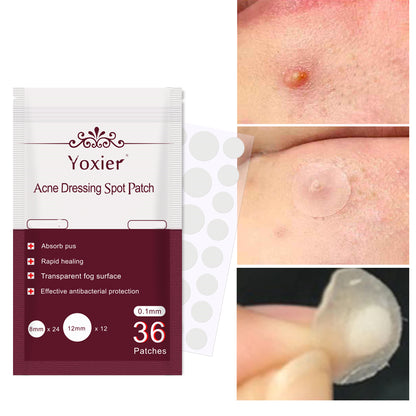 Skin Care Tools Acne Dressing Spot Patch Blemish Treatment Invisible - Reiland Beauty Products, LLC