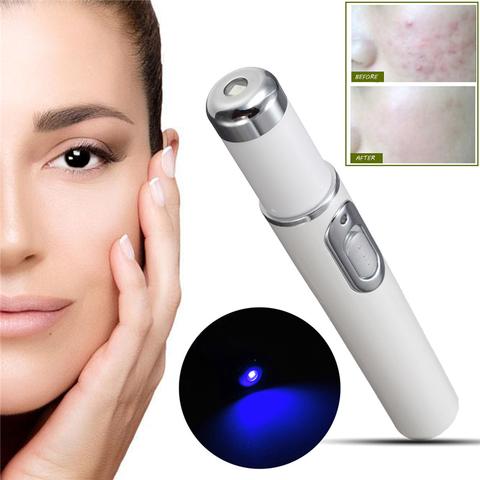 Blue Light Therapy Acne Laser Pen Soft Scar Wrinkle Removal Treatment - Reiland Beauty Products, LLC