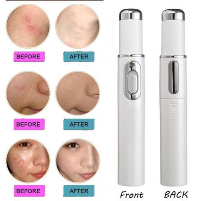 Blue Light Therapy Acne Laser Pen Soft Scar Wrinkle Removal Treatment - Reiland Beauty Products, LLC